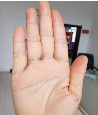 Palmistry fortune-telling: broken love line will meet divorce?