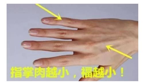 The palm of the 