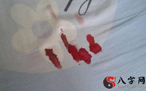 Dreaming of blood on clothes