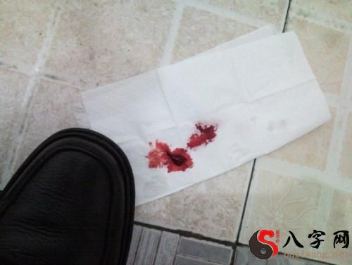 I dreamt I bled myself to death.