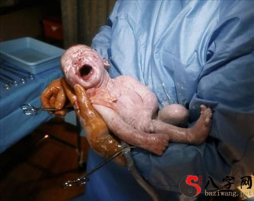 Dreaming of giving birth to a child with internal bleeding