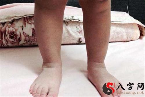 Dreaming of walking barefoot and stubbing your feet