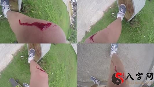 I dreamt I was bleeding from a fall.