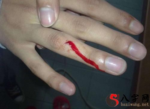 Dreaming of bleeding hands