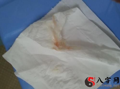 Dreaming of bleeding from a miscarriage