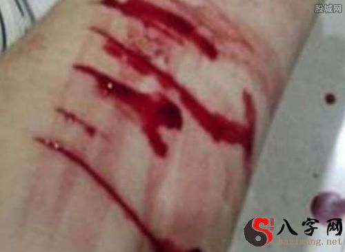 Dreaming of bleeding on the palm of my hand