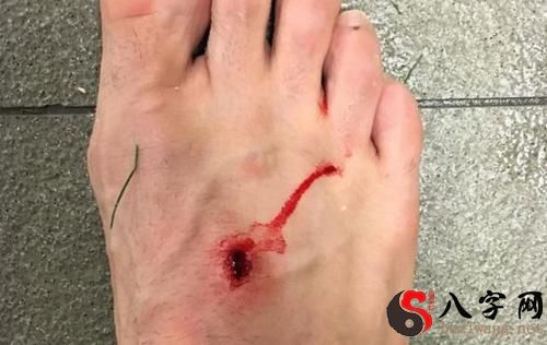 Dreaming of bleeding feet
