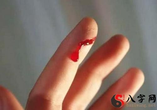 I dreamed of cutting my finger and bleeding.