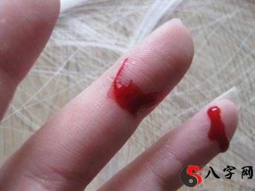 Dreaming of bleeding fingers