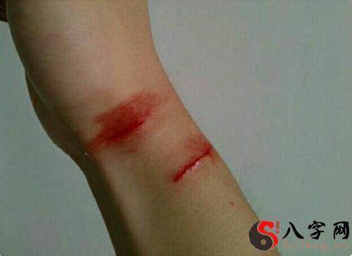 Dreaming of bleeding on the back of my hand