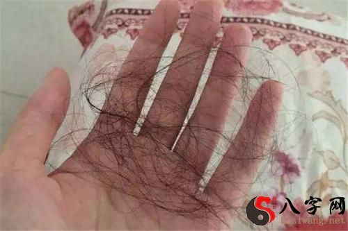 Dreaming of losing your hair