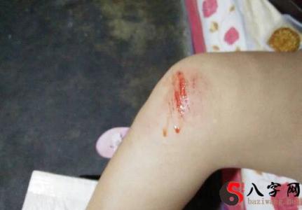 I dreamt that my son fell down the stairs and bled.