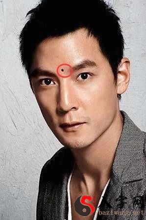If you have these moles on your face, you are bound to have a happy marriage! They will have two children!