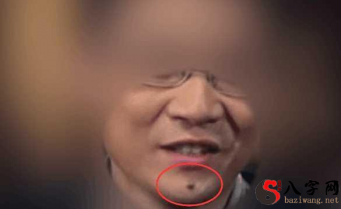 Expertise on Mole Colors for Men